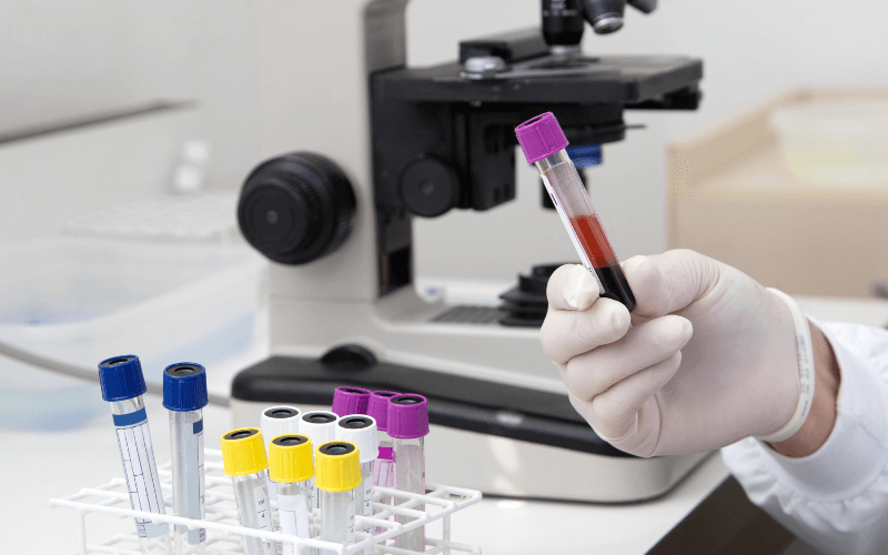 Mikroskop ve kan tüpleri ile laboratuvar ortamında kan testi süreci